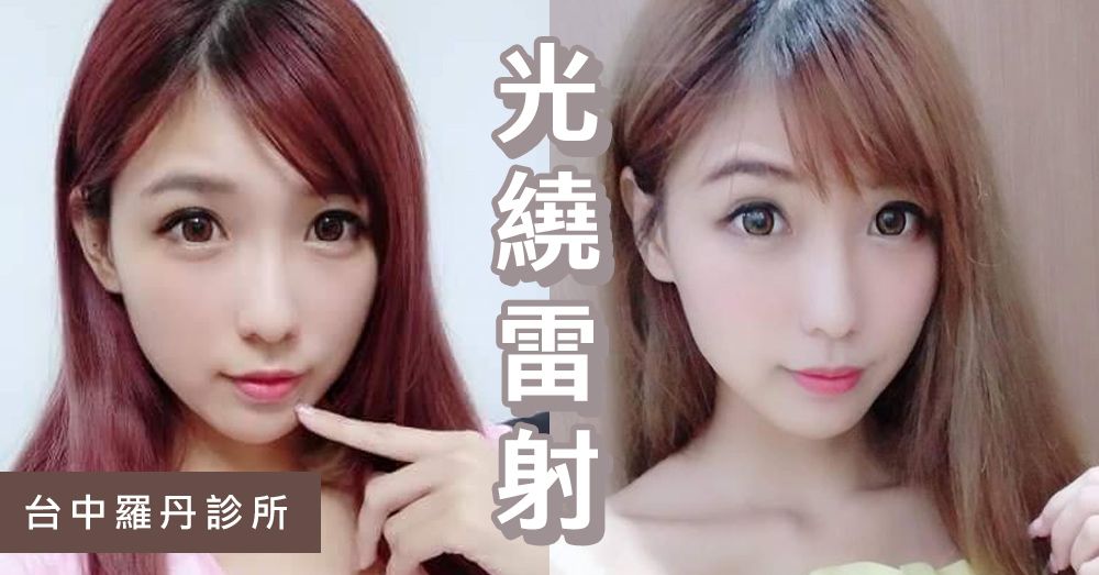 【台中‧光繞雷射/八倍淨膚雷射】已經是我的固定保養囉！台中羅丹的每月保養程序